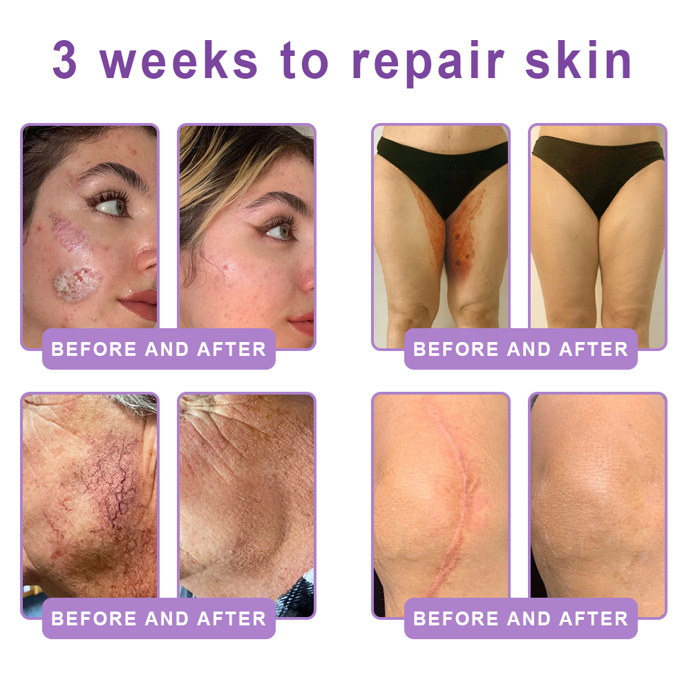 Wake Up Glowing with HISKIN® Glow & Firm Daily – Your Little Ritual for Radiant Skin