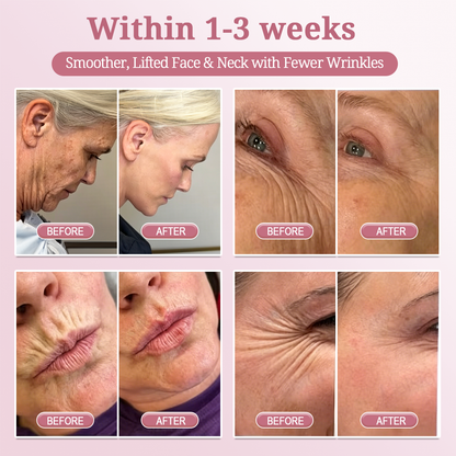HISKIN® BOTOX Collagen Night Wrapping Mask – Overnight Wrapping Care to Smooth Face & Neck Wrinkles, Firm Loose-Looking Skin, Brighten Dark Spots & Restore a Fresher Glow