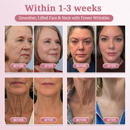 HISKIN® BOTOX Collagen Night Wrapping Mask – Overnight Wrapping Care to Smooth Face & Neck Wrinkles, Firm Loose-Looking Skin, Brighten Dark Spots & Restore a Fresher Glow