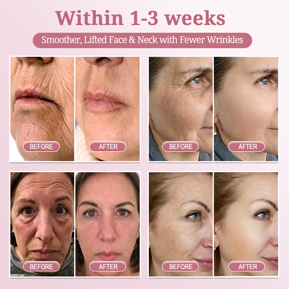 HISKIN® BOTOX Collagen Night Wrapping Mask – Overnight Wrapping Care to Smooth Face & Neck Wrinkles, Firm Loose-Looking Skin, Brighten Dark Spots & Restore a Fresher Glow