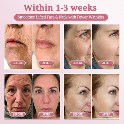HISKIN® BOTOX Collagen Night Wrapping Mask – Overnight Wrapping Care to Smooth Face & Neck Wrinkles, Firm Loose-Looking Skin, Brighten Dark Spots & Restore a Fresher Glow